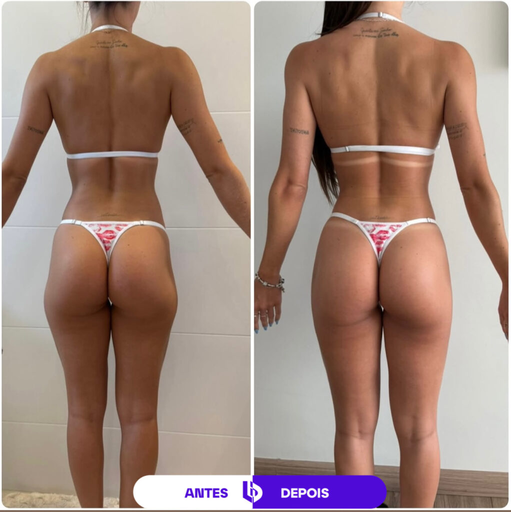 Comparação de antes e depois de transformação corporal feminina, mostrando evolução da definição abdominal e muscular.