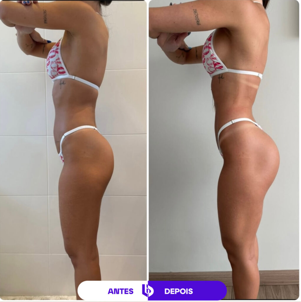 Comparação de antes e depois de transformação corporal feminina, mostrando evolução da definição abdominal e muscular.
